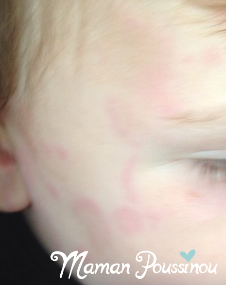 Lire la suite à propos de l’article Les allergies de bébé : les déceler, les comprendre et réduire les risques