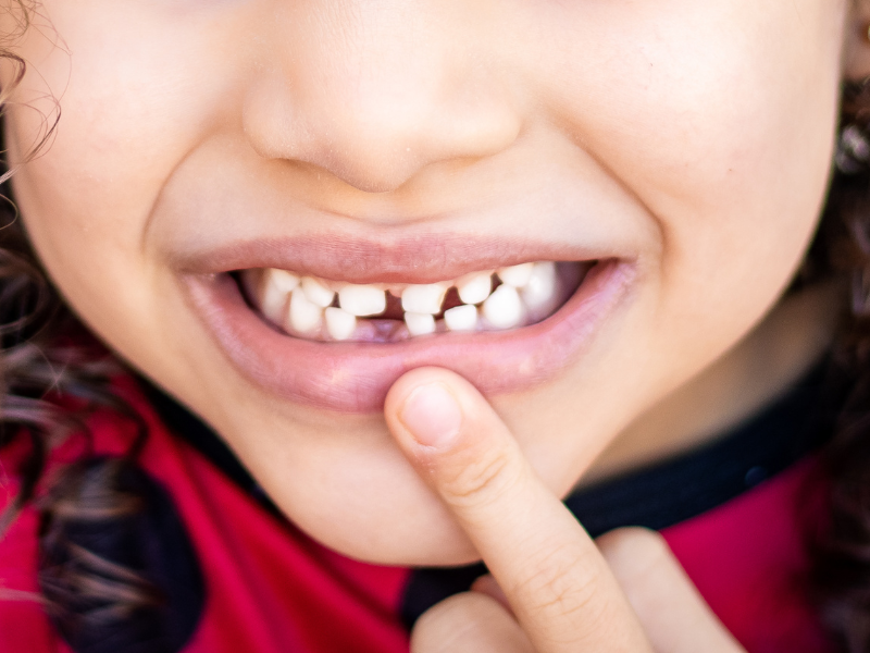 Soins dentaires et pédodontie chez l’enfant Soins dentaires et pédodontie chez l’enfant